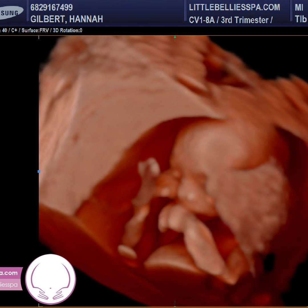 Photo shared by Hannah for their Babylist baby registry.