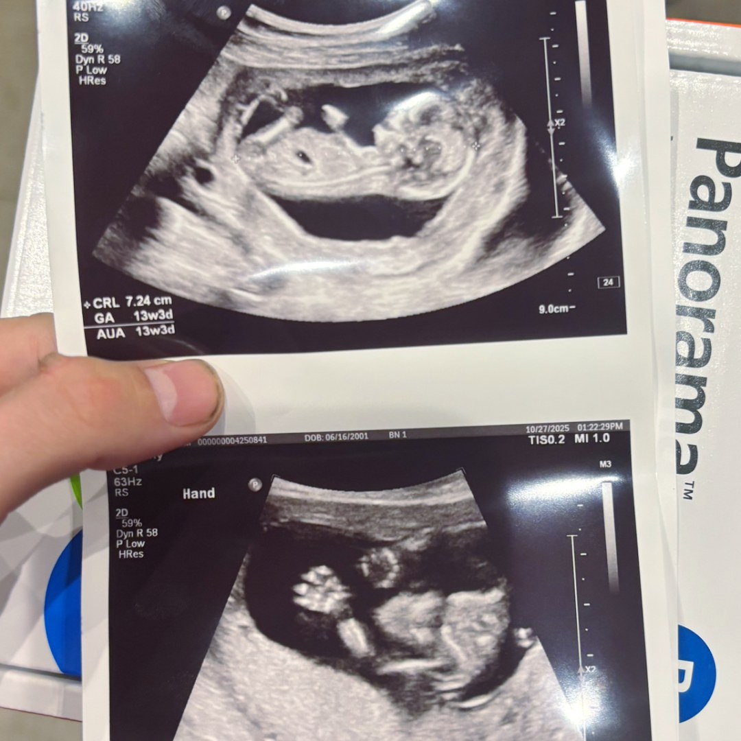 Photo shared by Alexis for their Babylist baby registry.