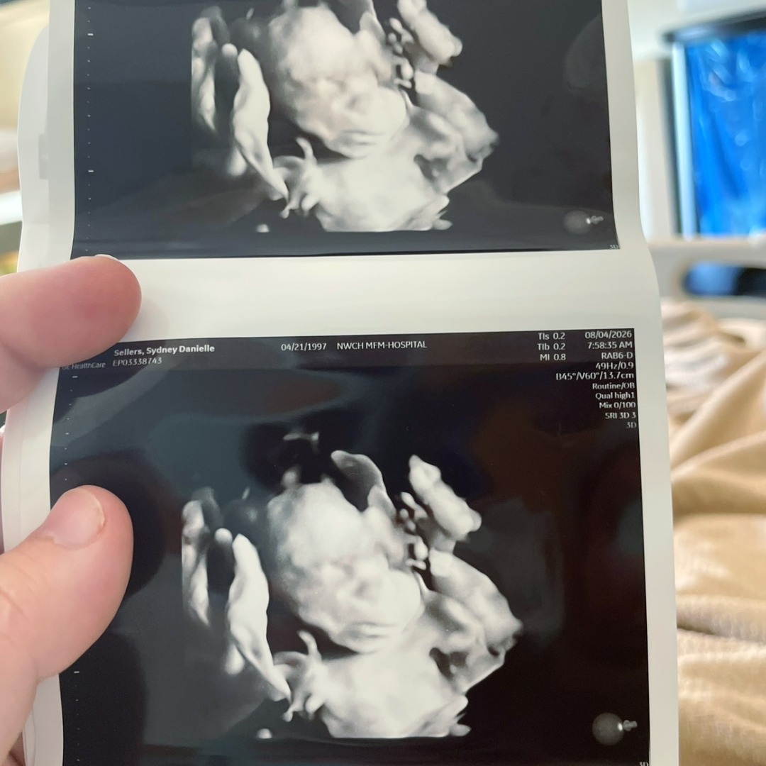 Photo shared by Sydney for their Babylist baby registry.