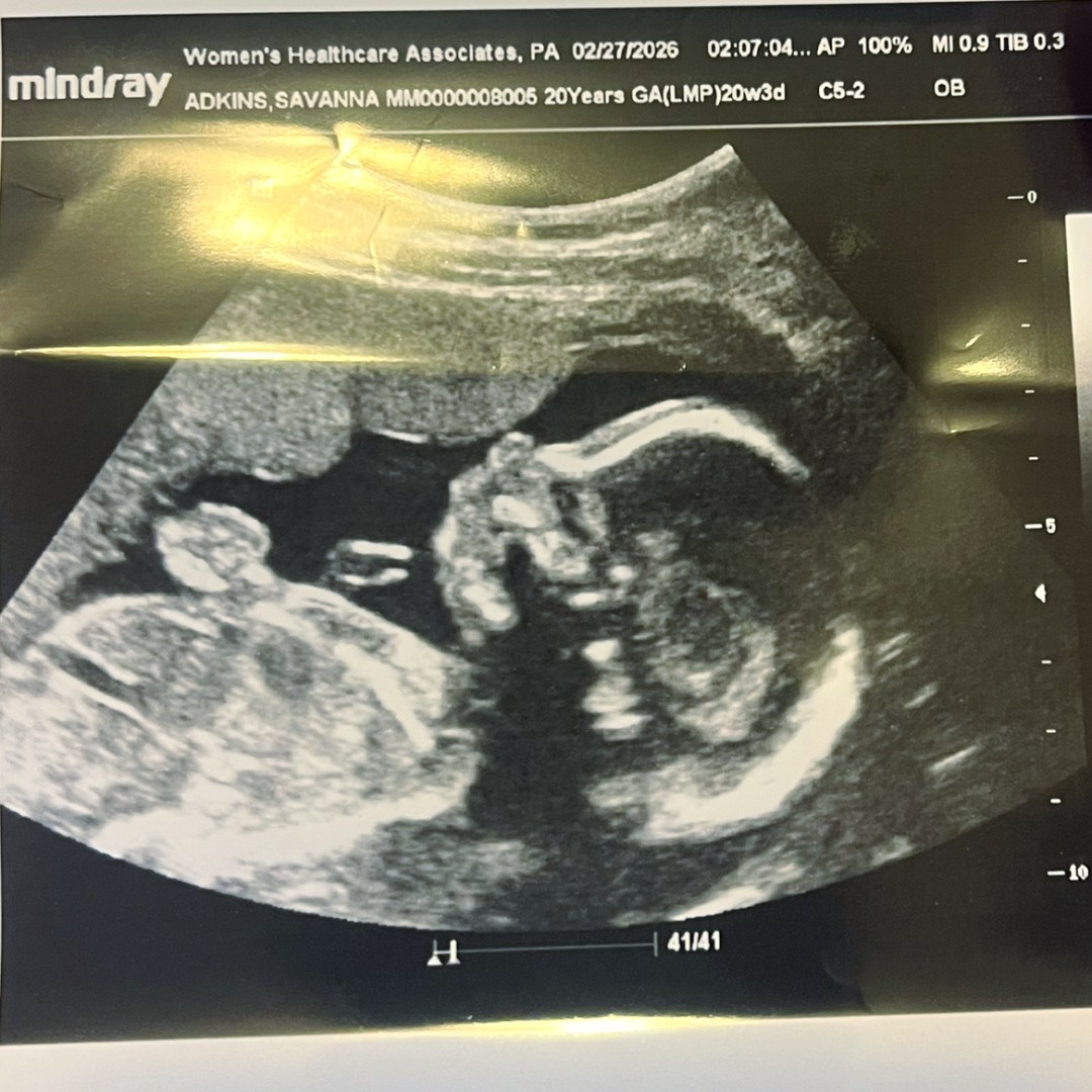 Photo shared by Savanna for their Babylist baby registry.