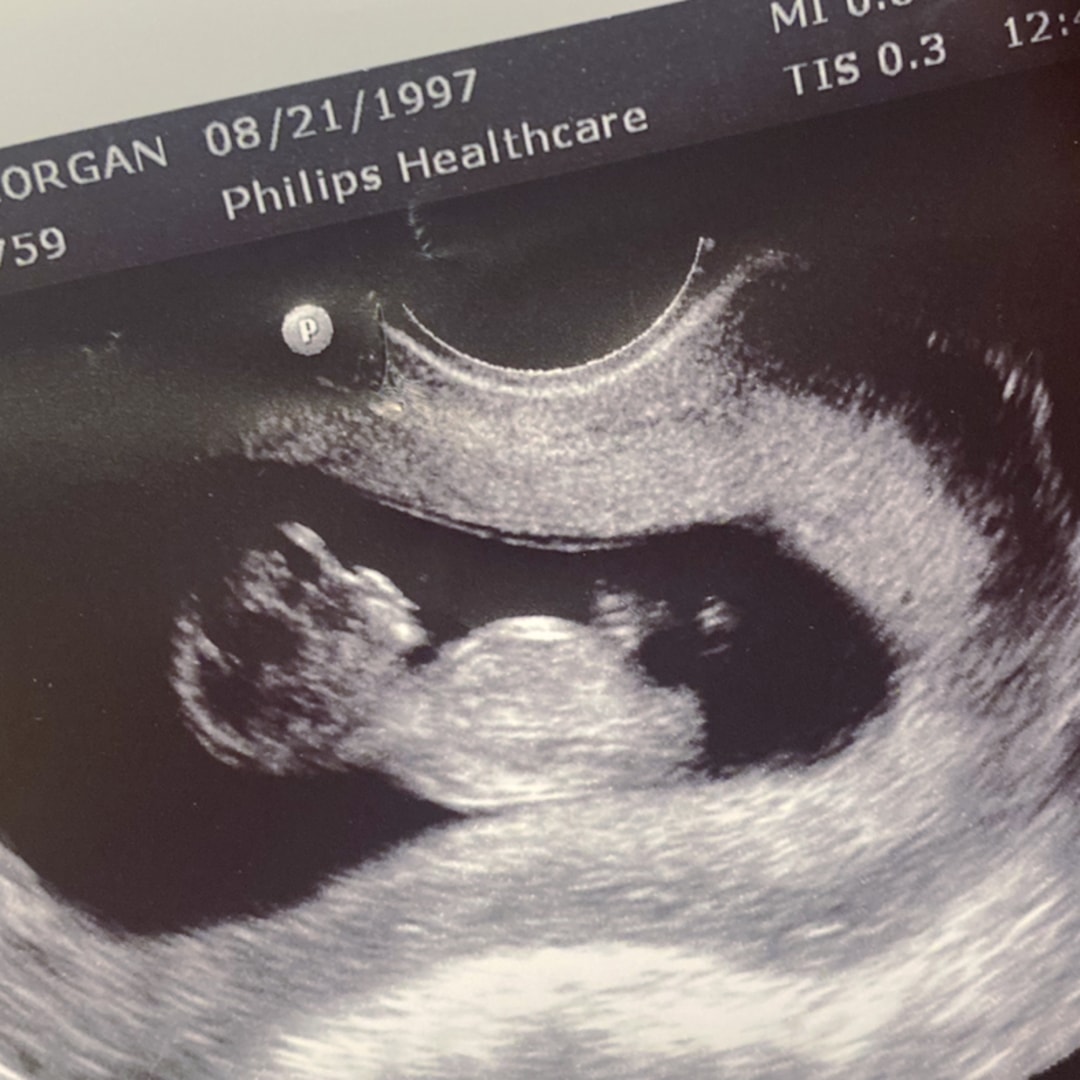 Photo shared by Morgan for their Babylist baby registry.