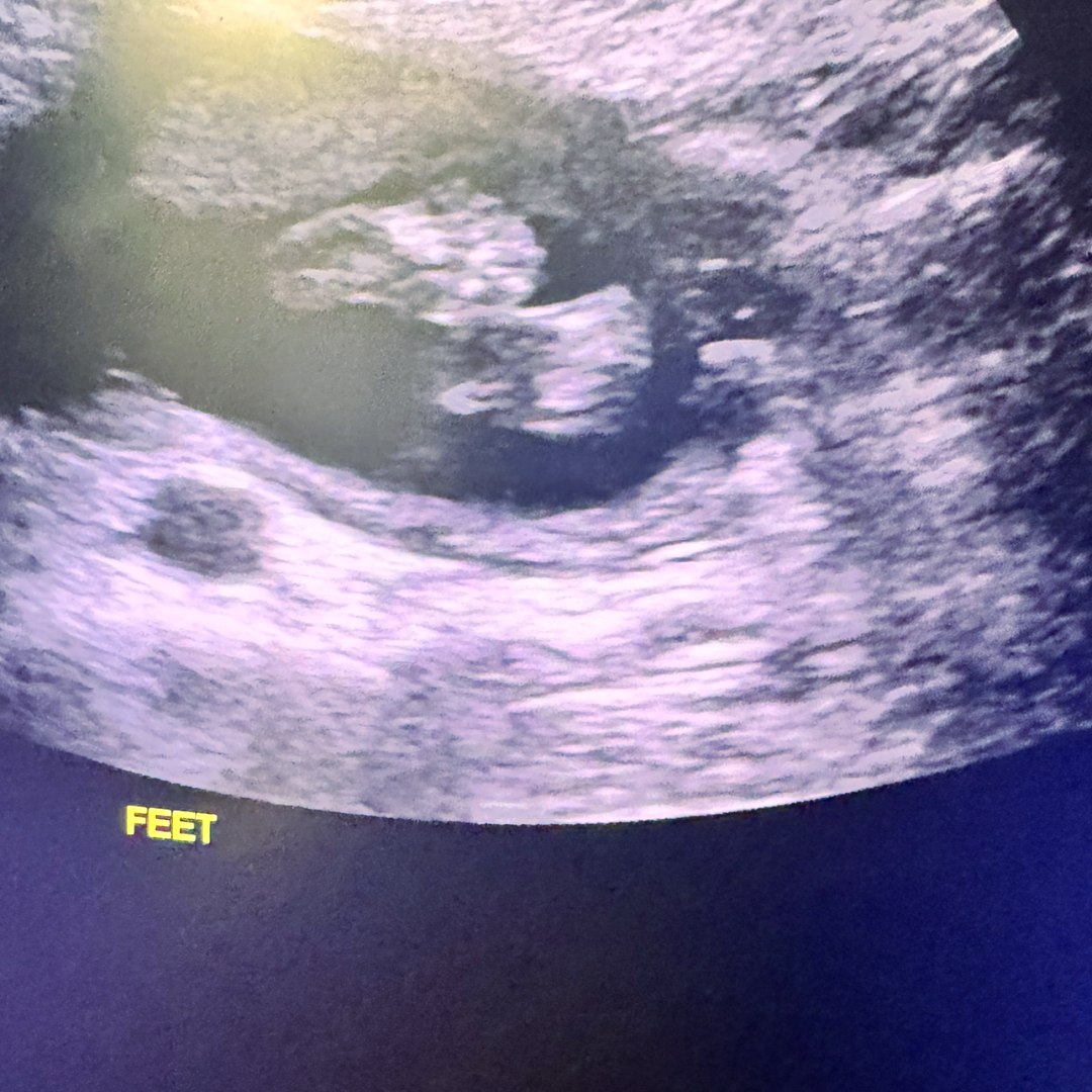 Photo shared by Jaydn for their Babylist baby registry.