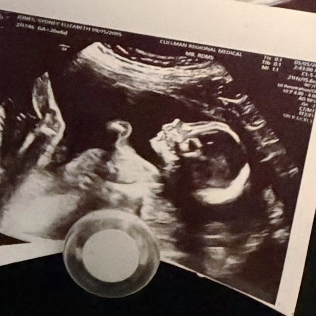 Photo shared by Sydney for their Babylist baby registry.