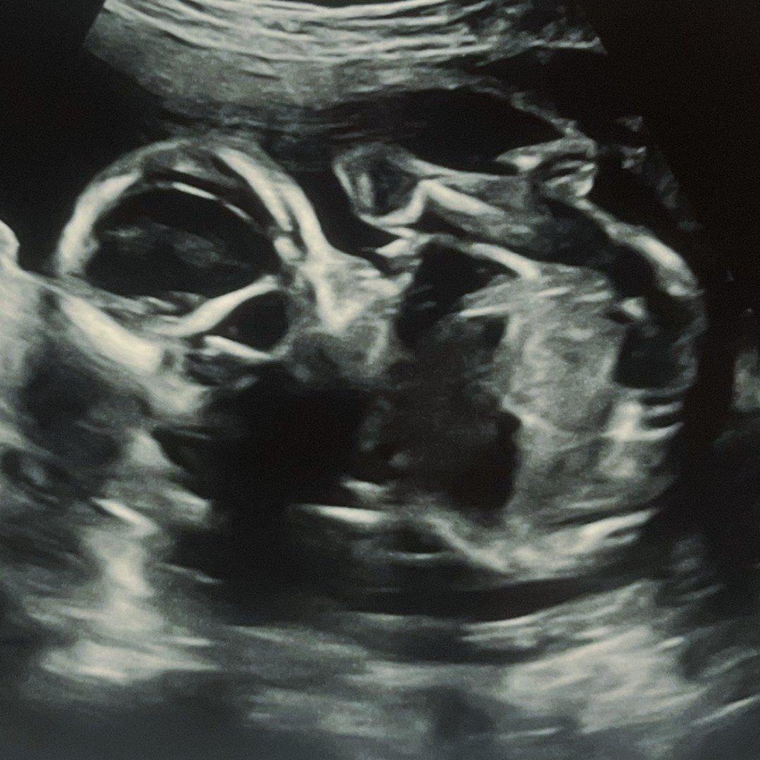 Photo shared by Emma for their Babylist baby registry.