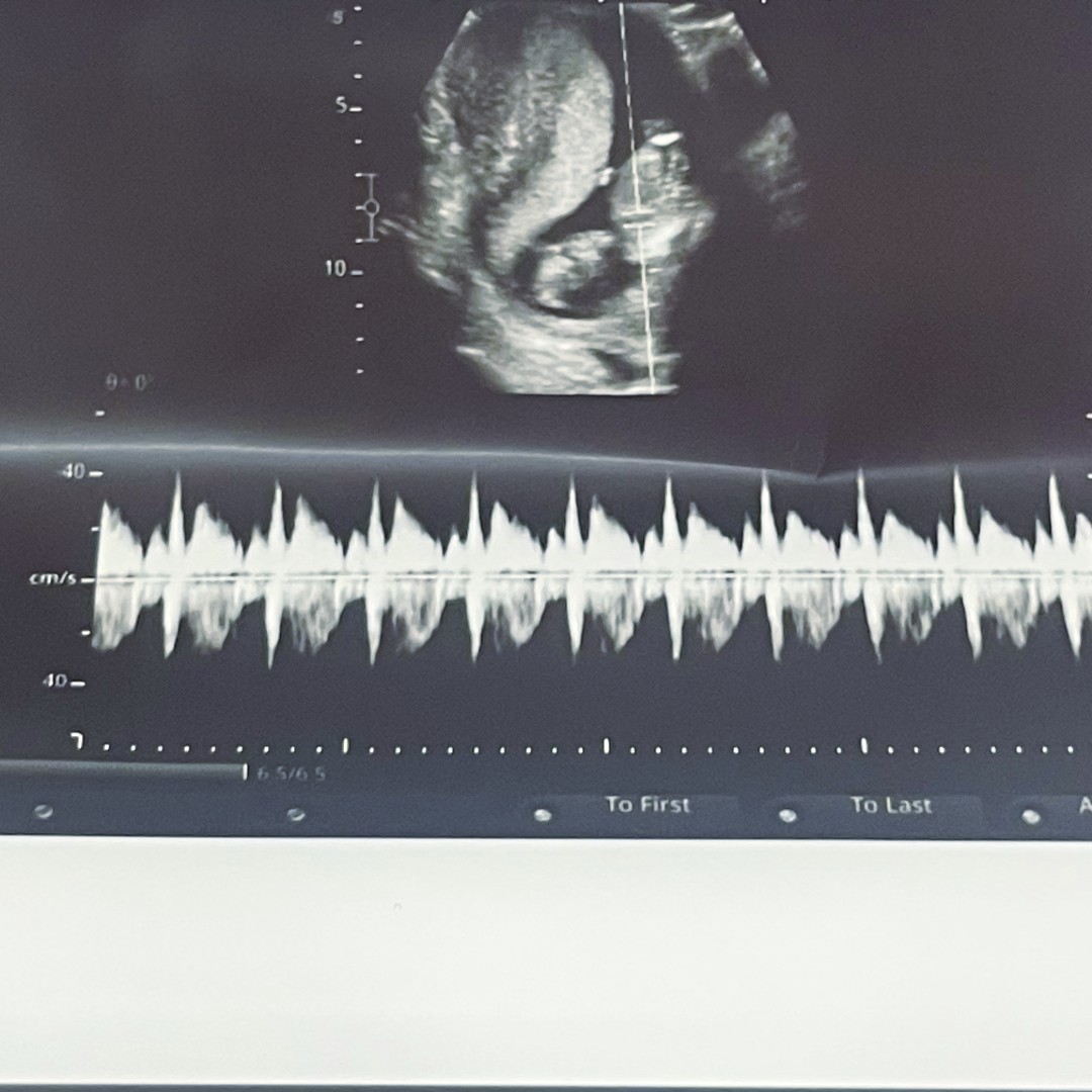 Photo shared by Dasia for their Babylist baby registry.
