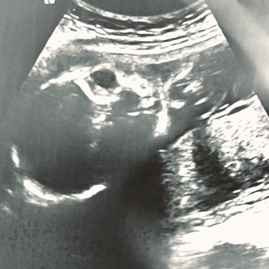 Photo shared by Lana for their Babylist baby registry.