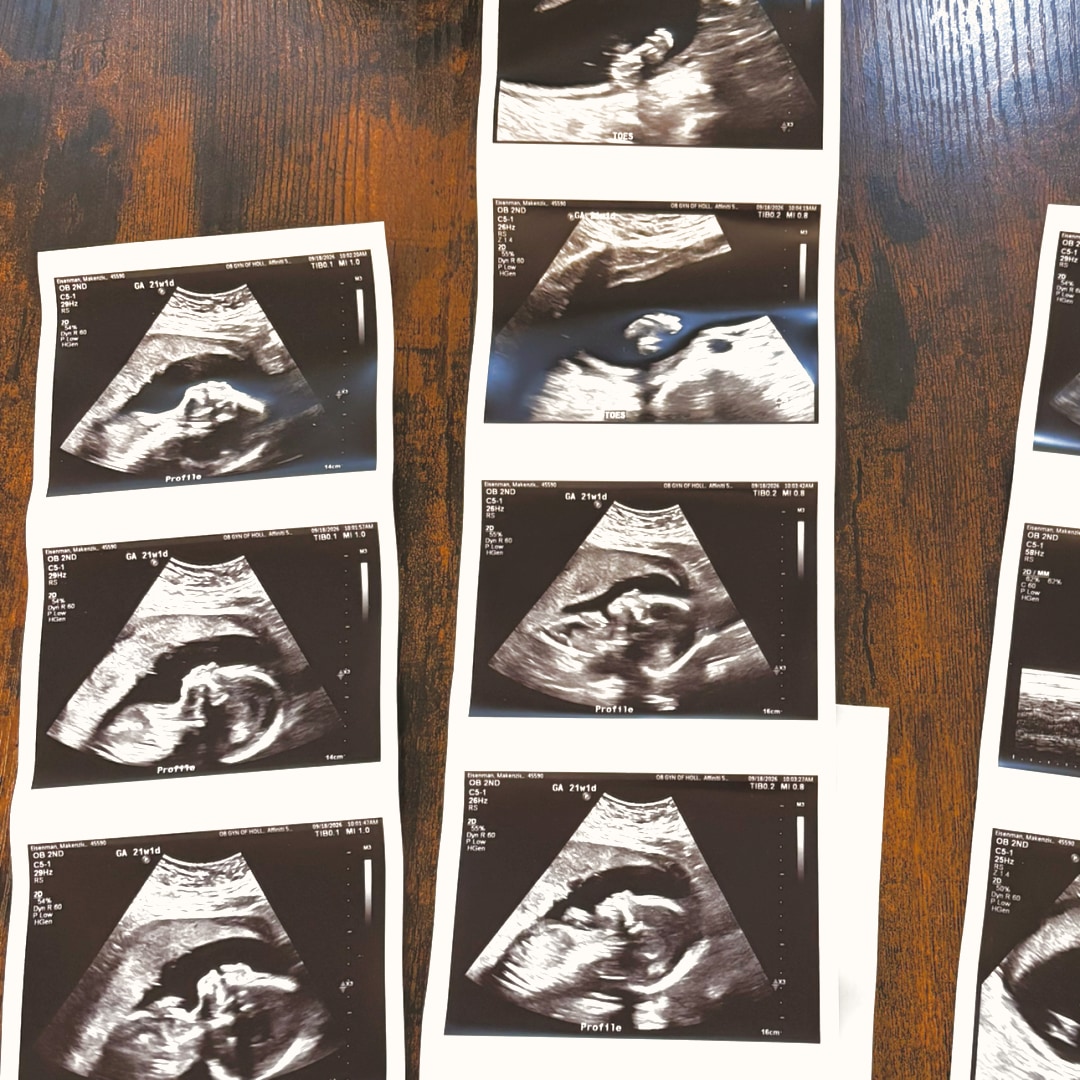 Photo shared by Makenzie for their Babylist baby registry.