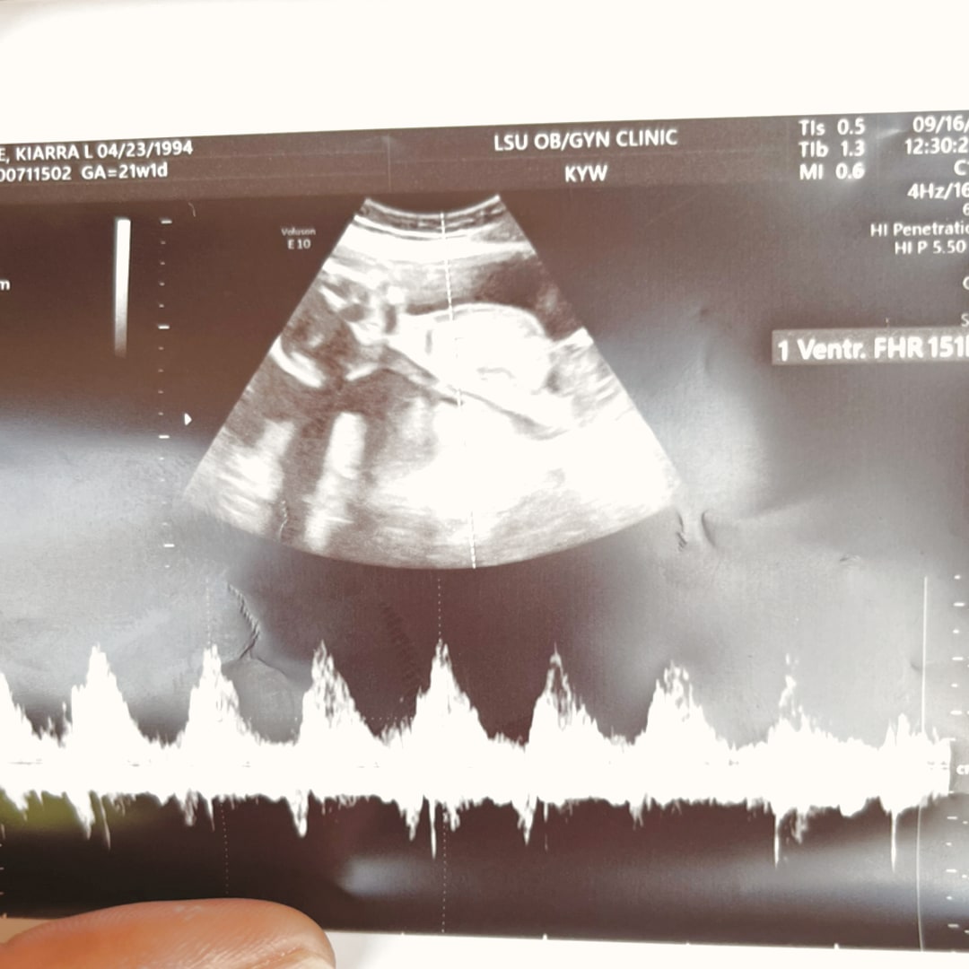 Photo shared by Kiarra for their Babylist baby registry.