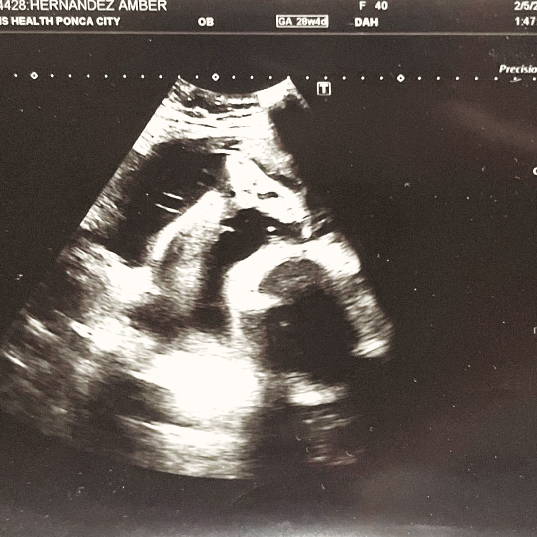 Photo shared by Amber for their Babylist baby registry.