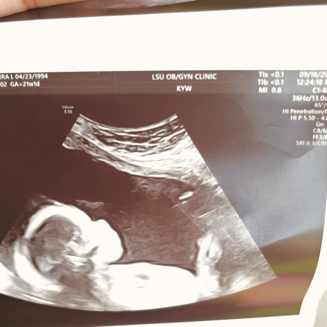 Photo shared by Kiarra for their Babylist baby registry.