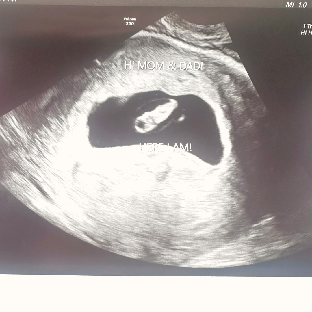 Photo shared by Jessica for their Babylist baby registry.