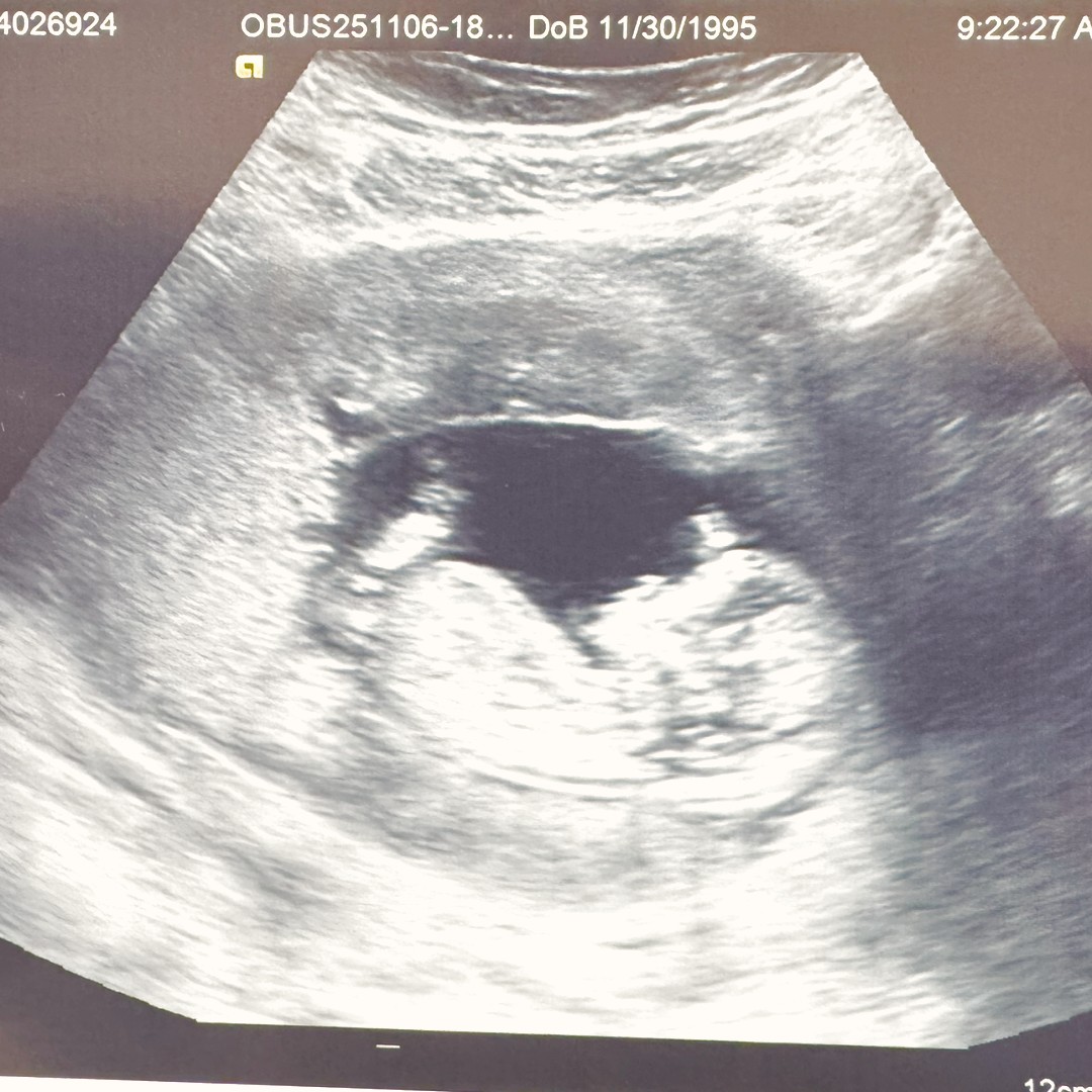 Photo shared by Rachel for their Babylist baby registry.