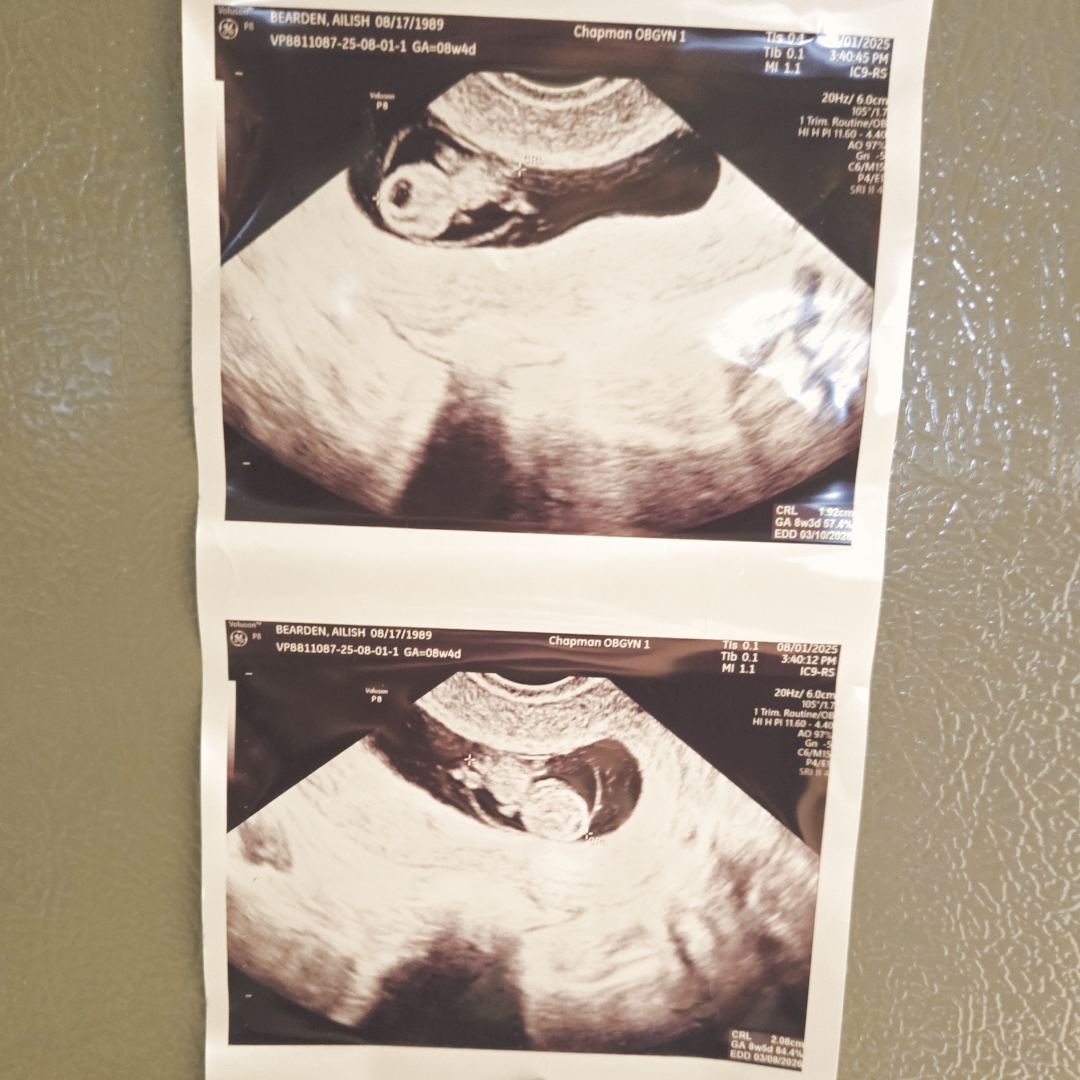 Photo shared by Ailish for their Babylist baby registry.