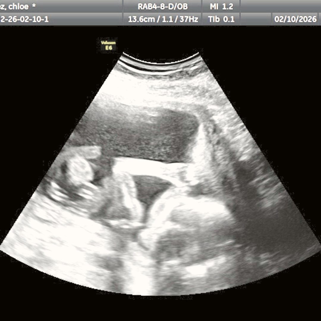 Photo shared by Chloe for their Babylist baby registry.