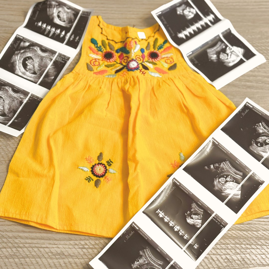 Photo shared by Dyimond for their Babylist baby registry.