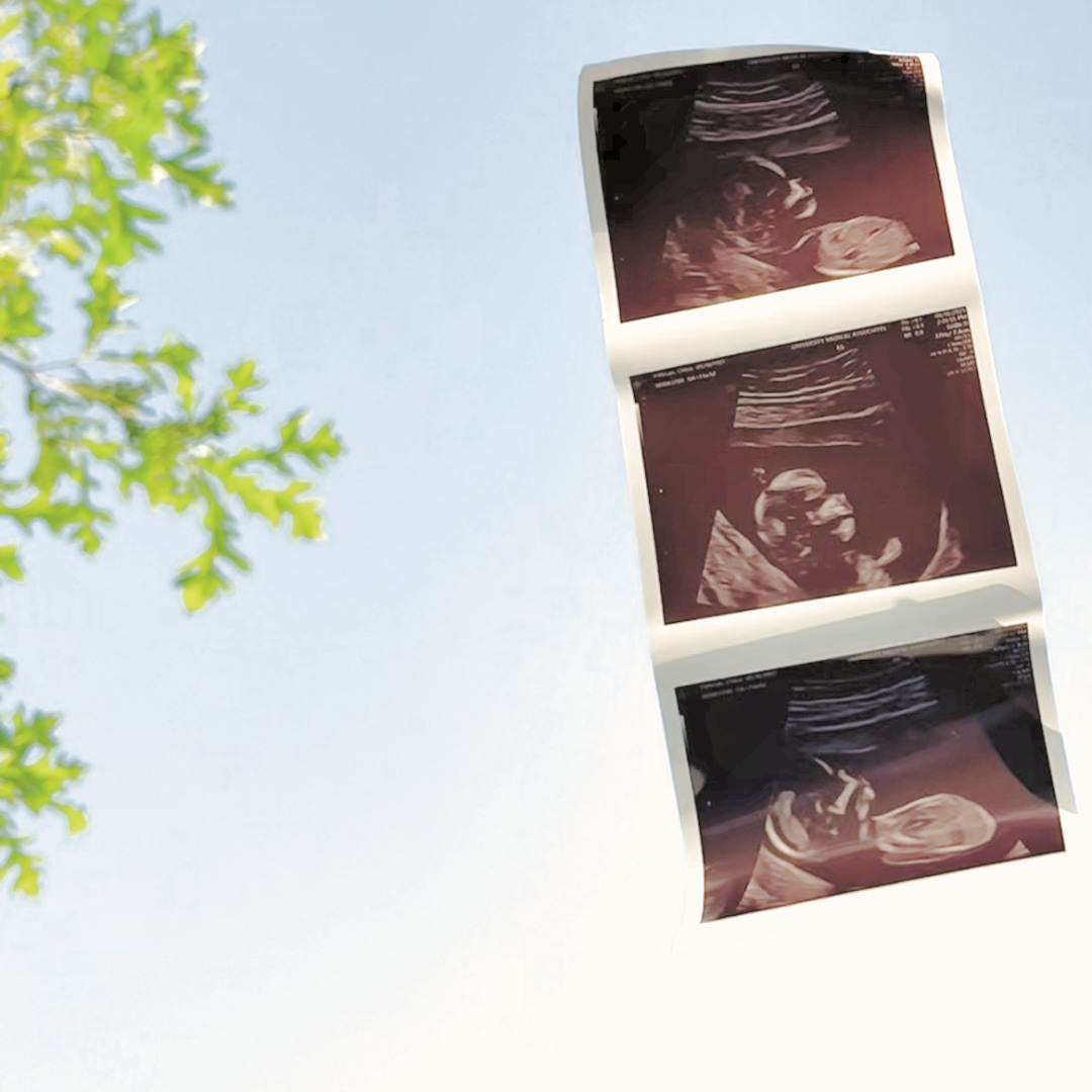 Photo shared by Chloe for their Babylist baby registry.