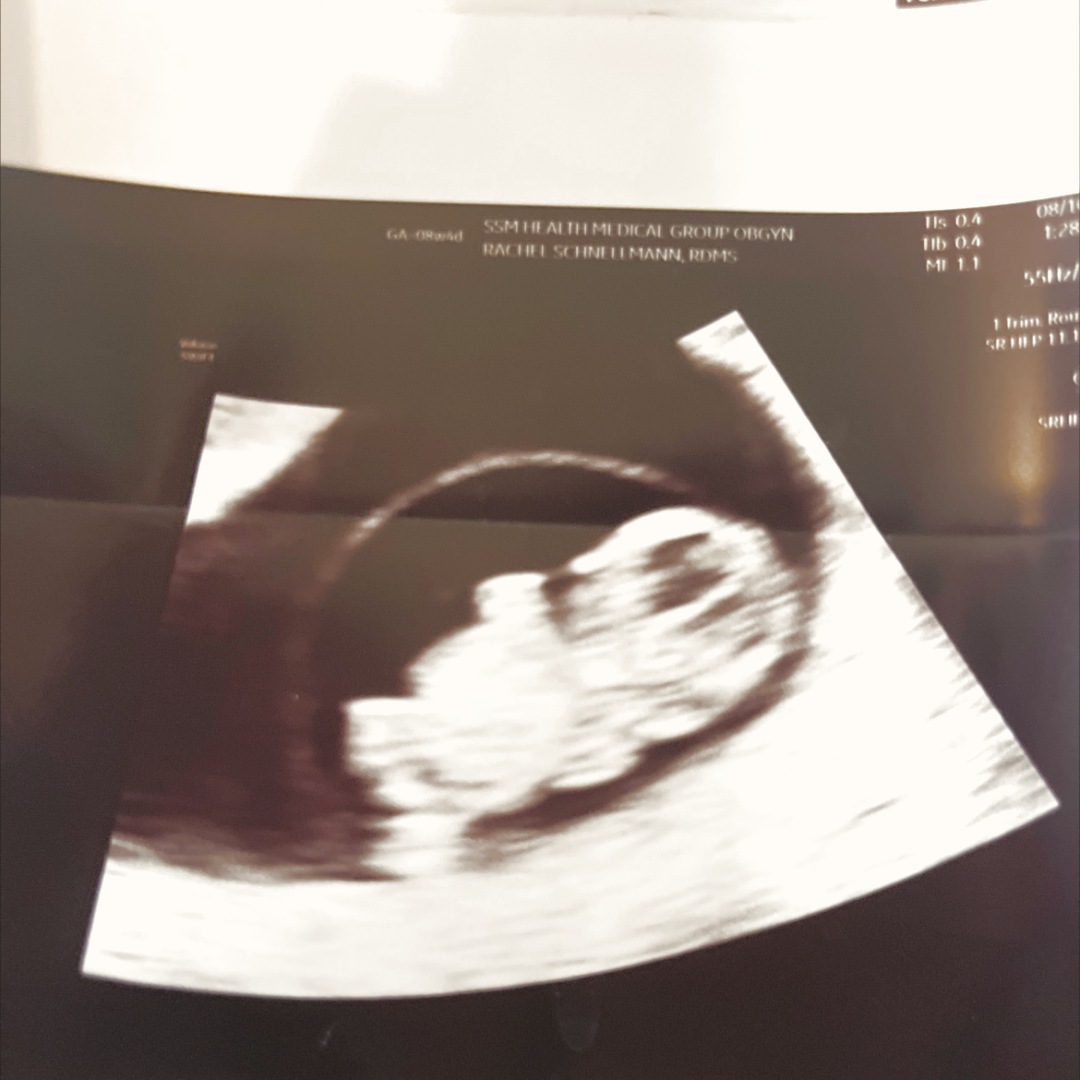 Photo shared by Claira for their Babylist baby registry.