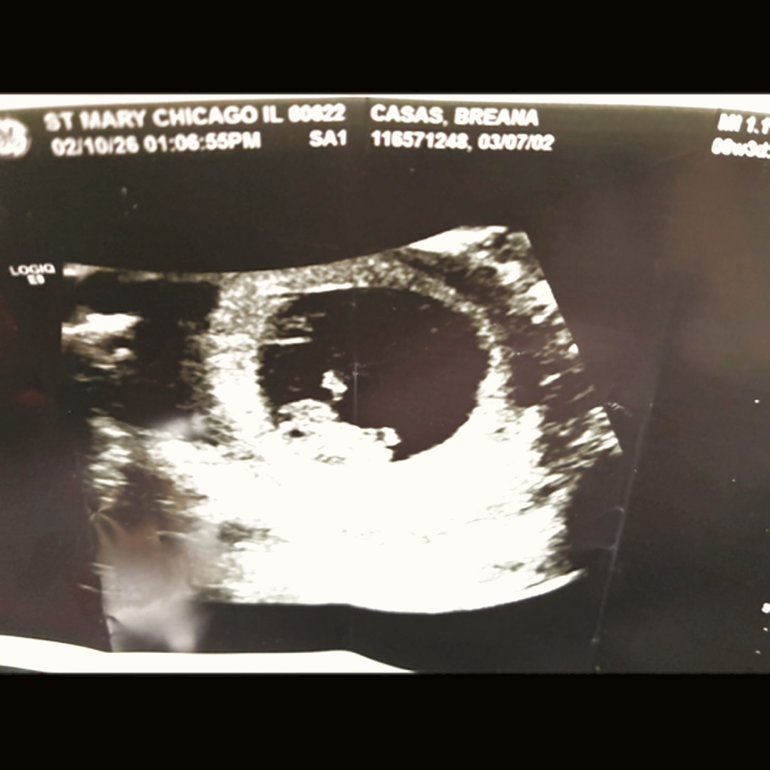 Photo shared by Breana for their Babylist baby registry.