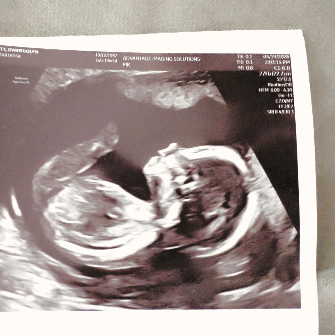 Photo shared by Gwendolyn for their Babylist baby registry.