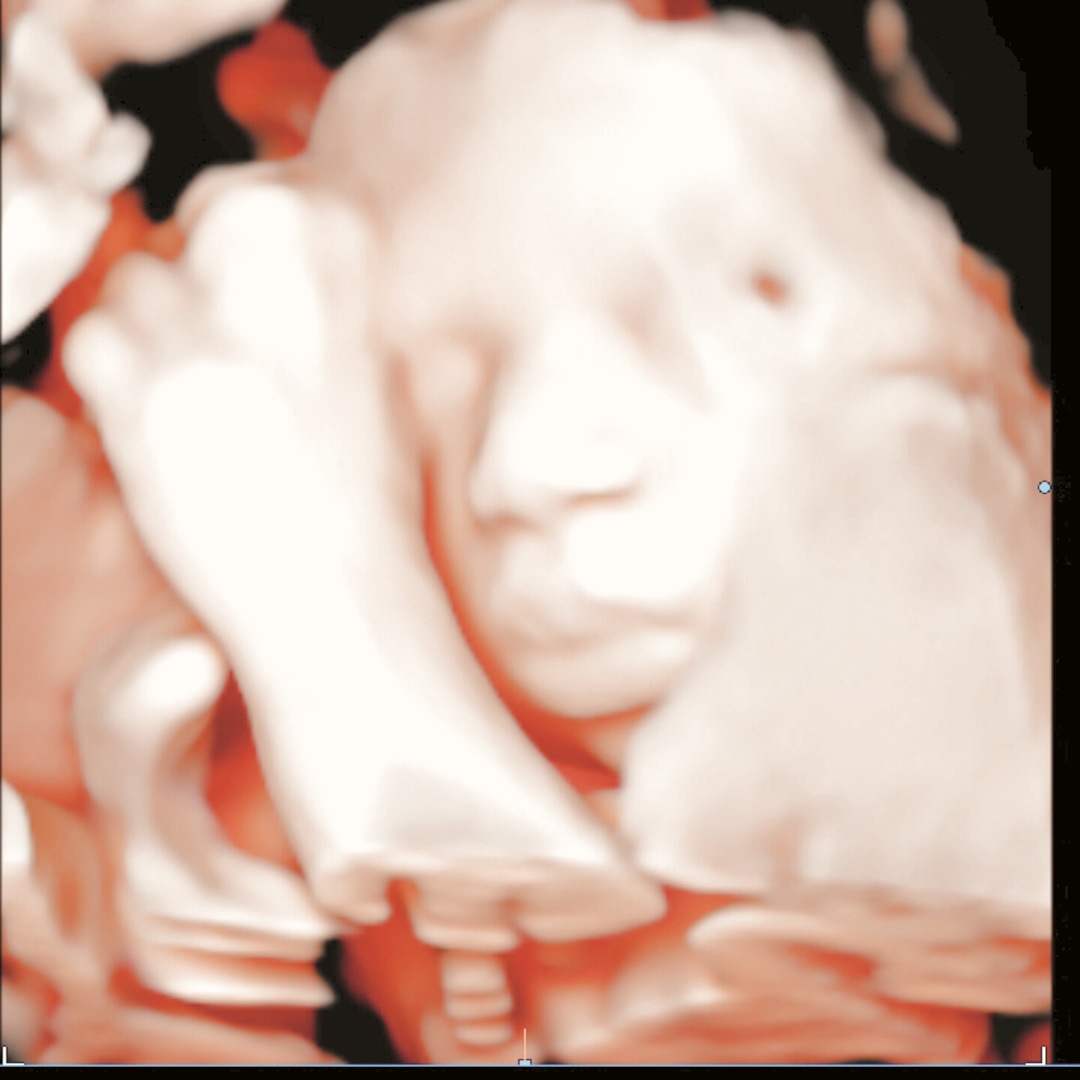 Photo shared by Priscilla for their Babylist baby registry.