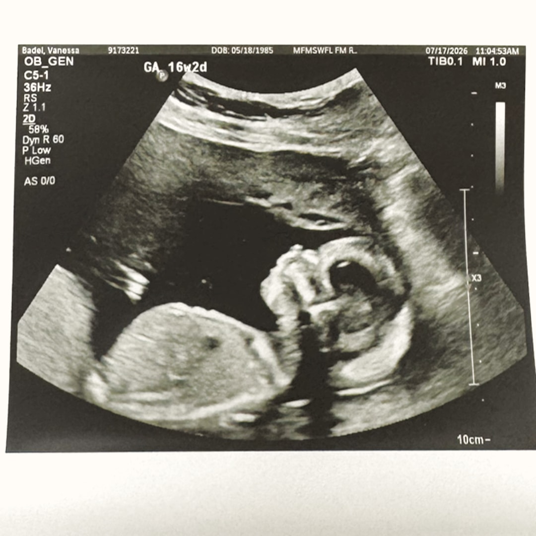 Photo shared by Vanessa for their Babylist baby registry.