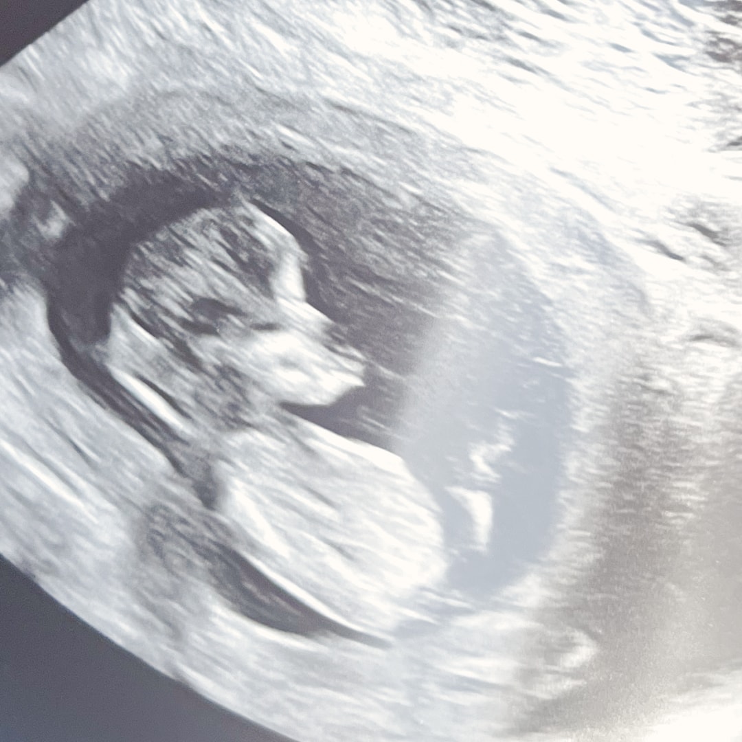 Photo shared by Kimberly for their Babylist baby registry.