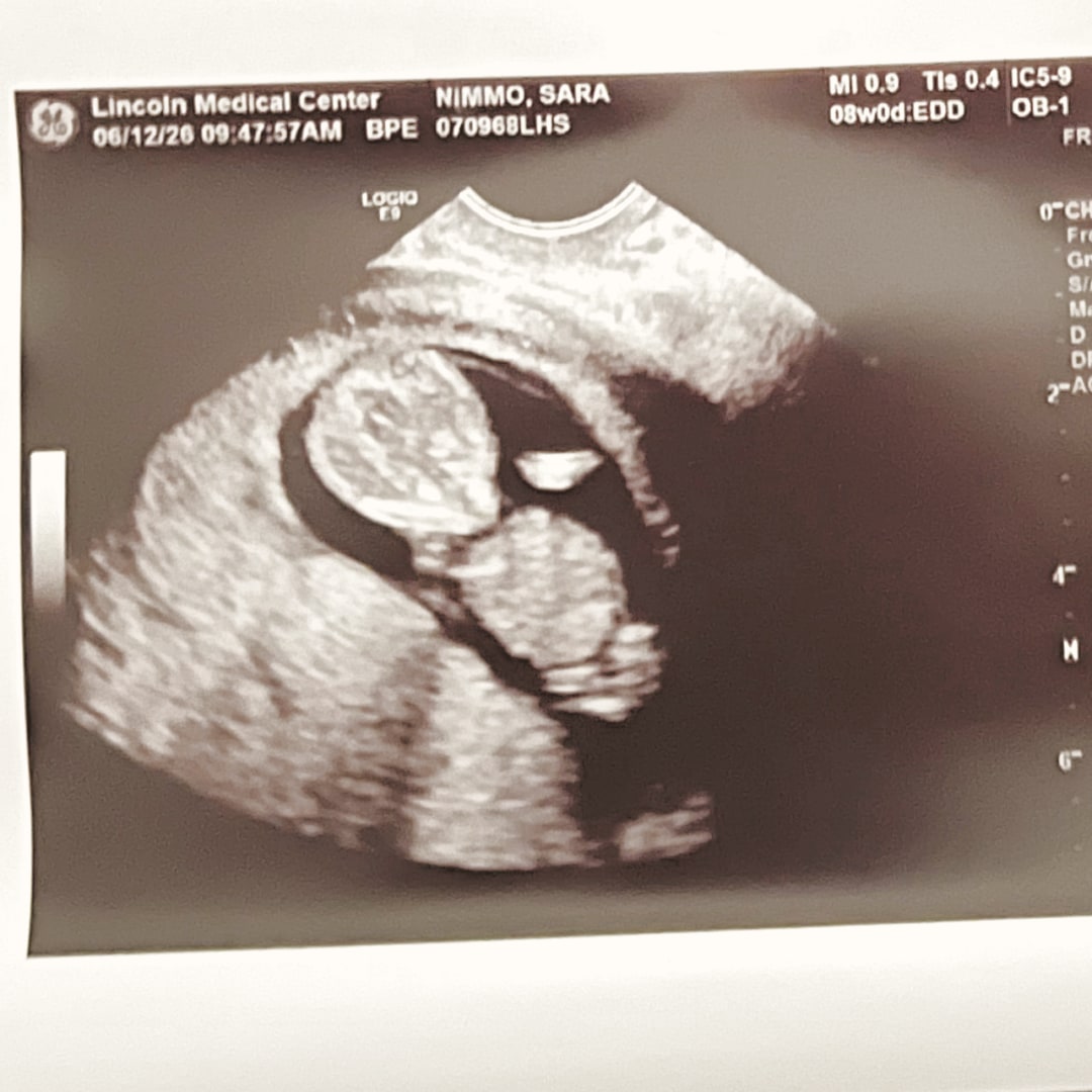 Photo shared by Sara for their Babylist baby registry.