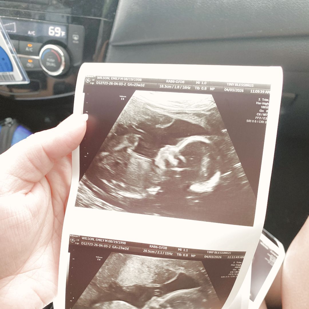 Photo shared by Emily for their Babylist baby registry.
