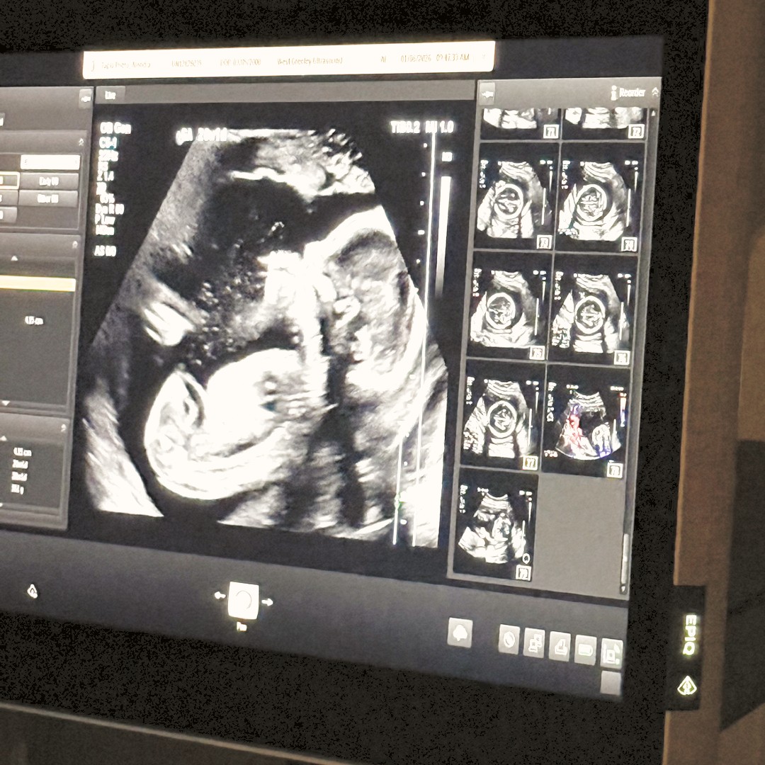 Photo shared by Alondra for their Babylist baby registry.