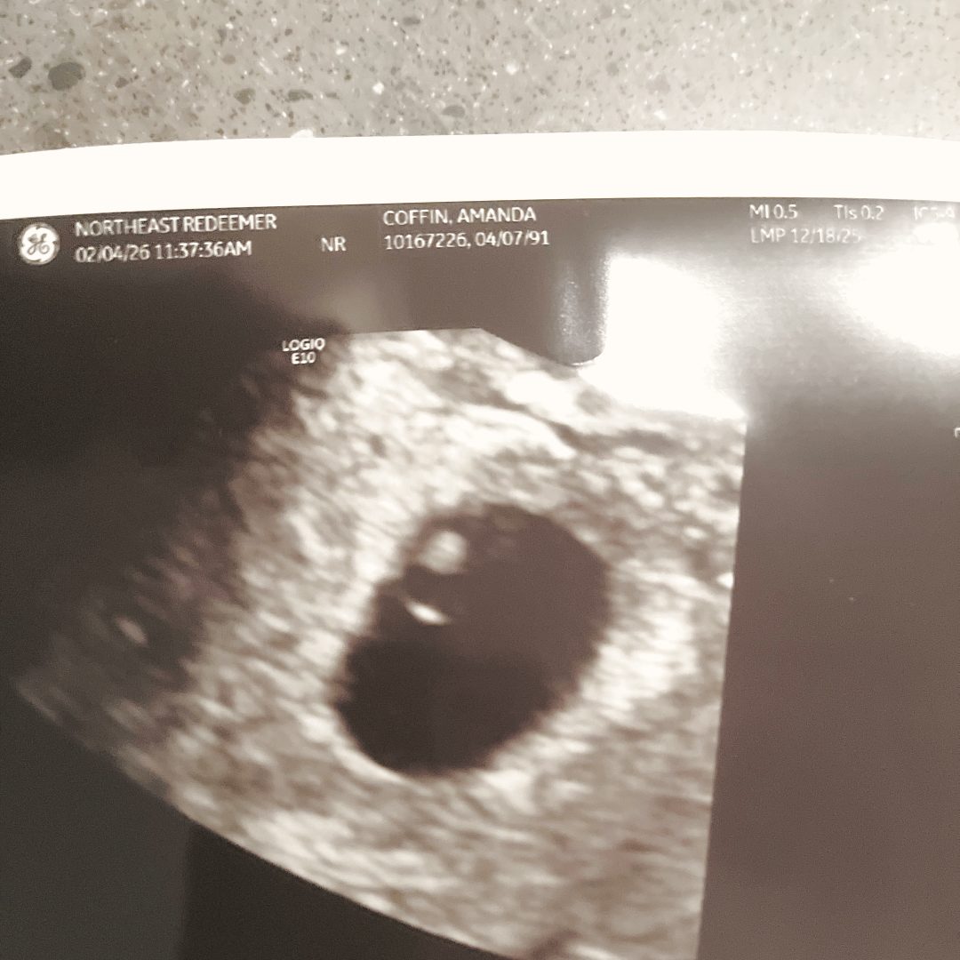 Photo shared by Amanda for their Babylist baby registry.
