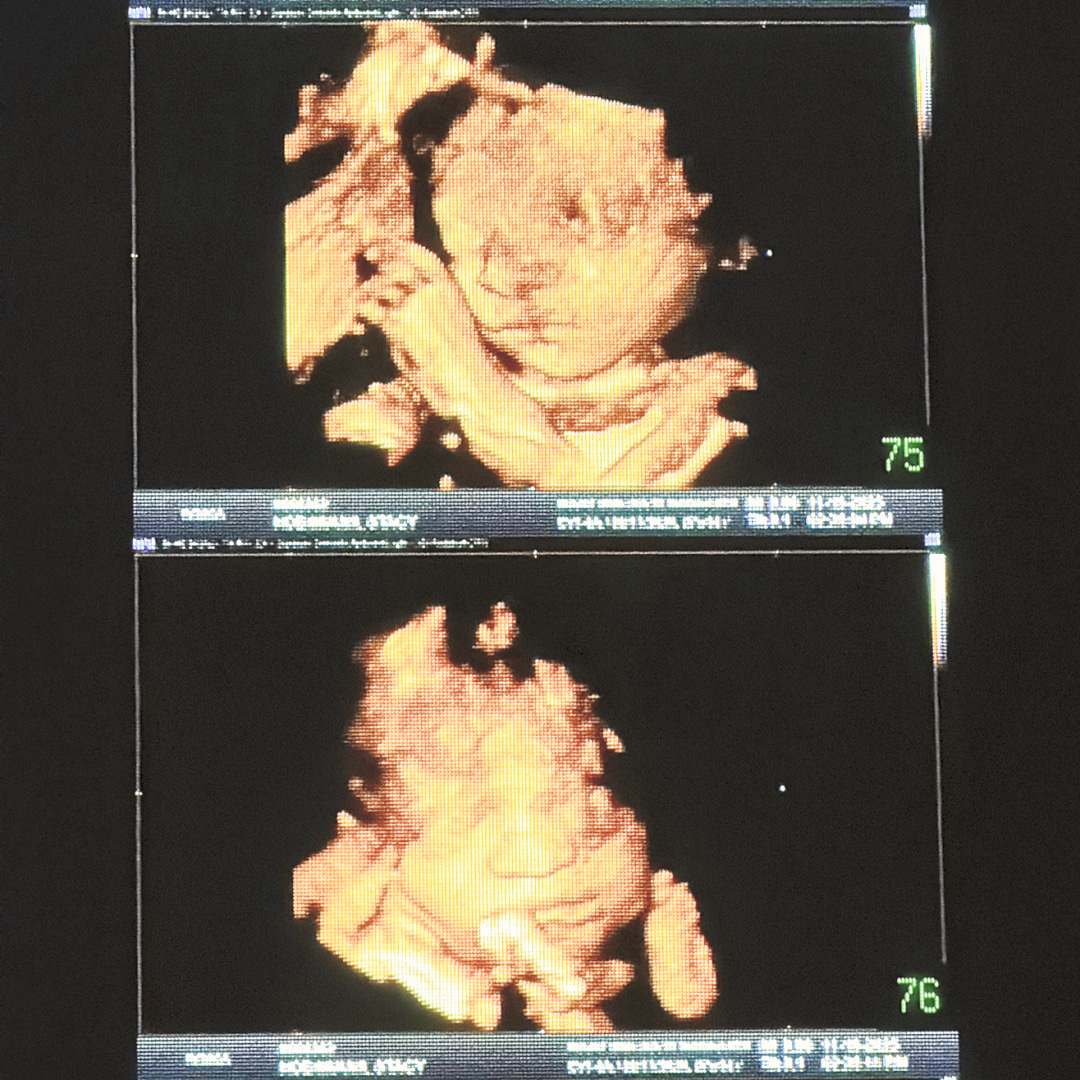 Photo shared by Stacy for their Babylist baby registry.