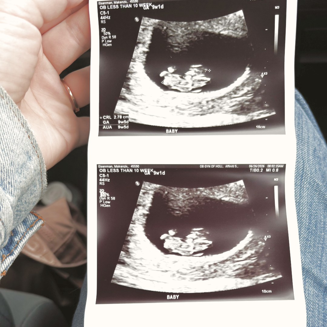 Photo shared by Makenzie for their Babylist baby registry.