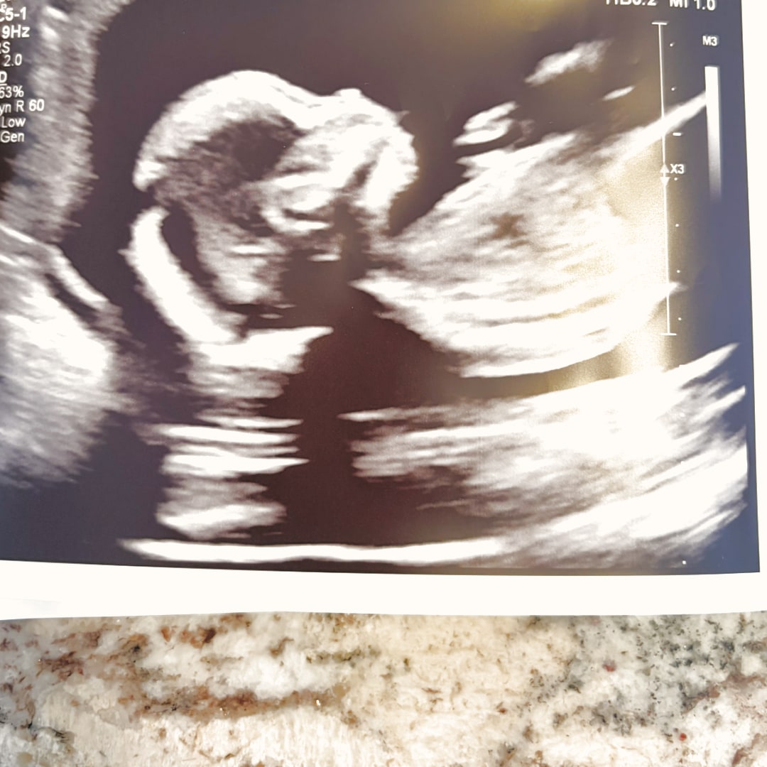 Photo shared by Jessica for their Babylist baby registry.