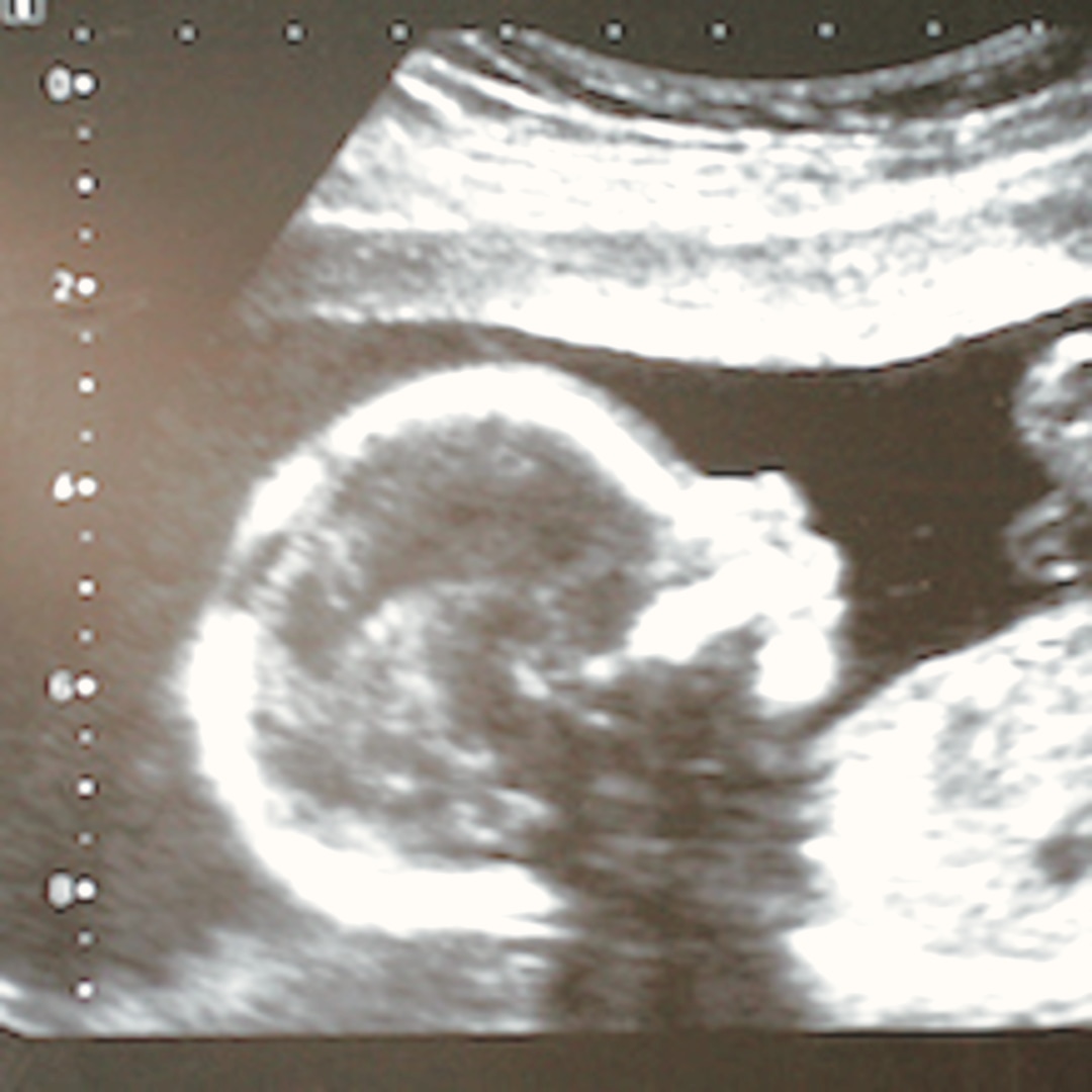 Photo shared by Justine for their Babylist baby registry.