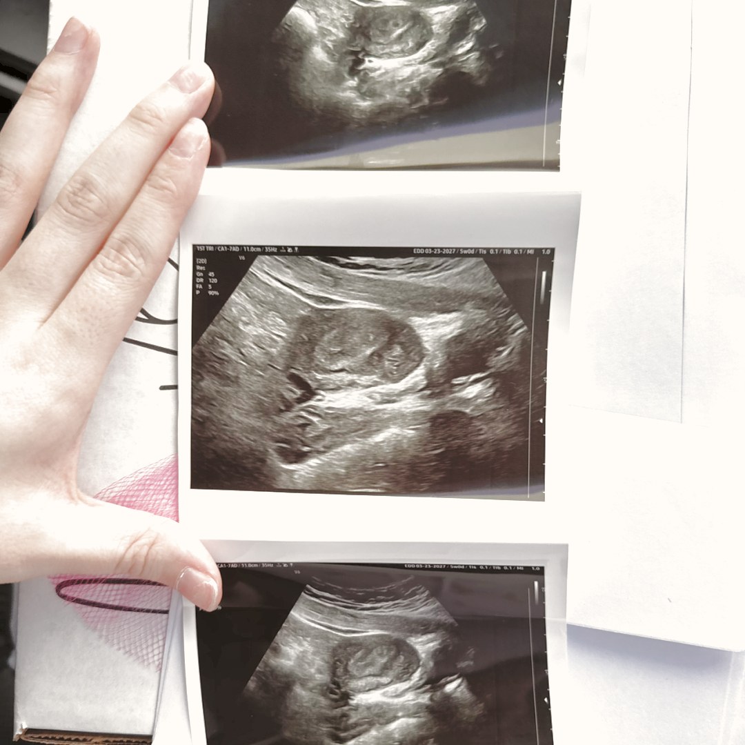 Photo shared by Miracle for their Babylist baby registry.