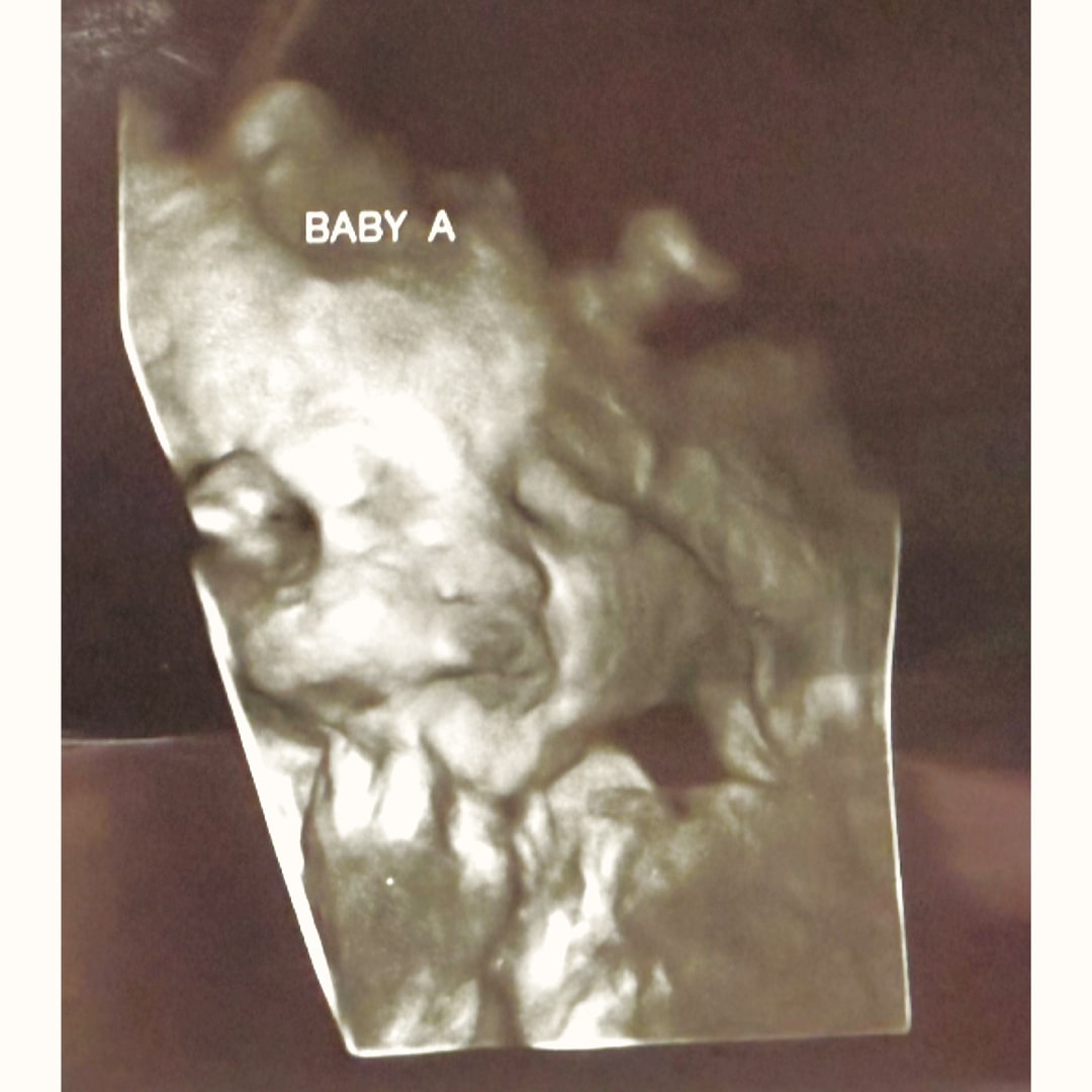 Photo shared by Karyssa for their Babylist baby registry.