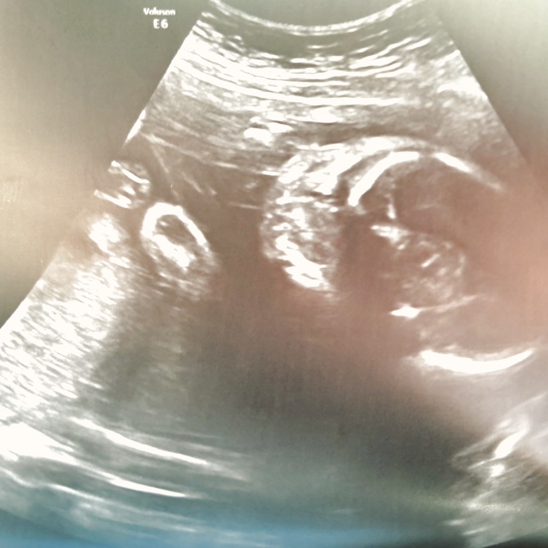 Photo shared by Lana for their Babylist baby registry.