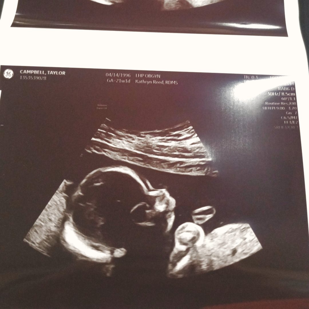 Photo shared by Taylor for their Babylist baby registry.