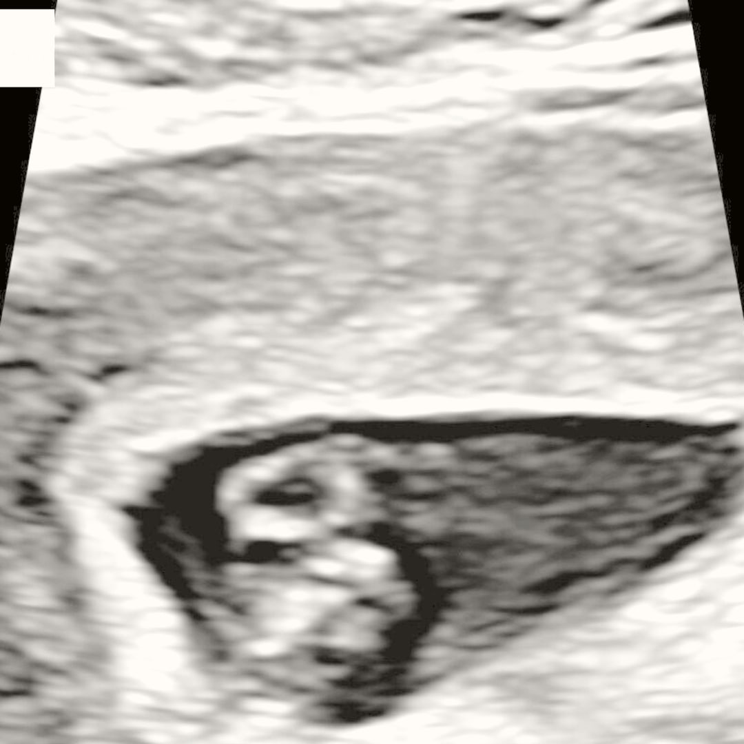 Photo shared by Alexis for their Babylist baby registry.