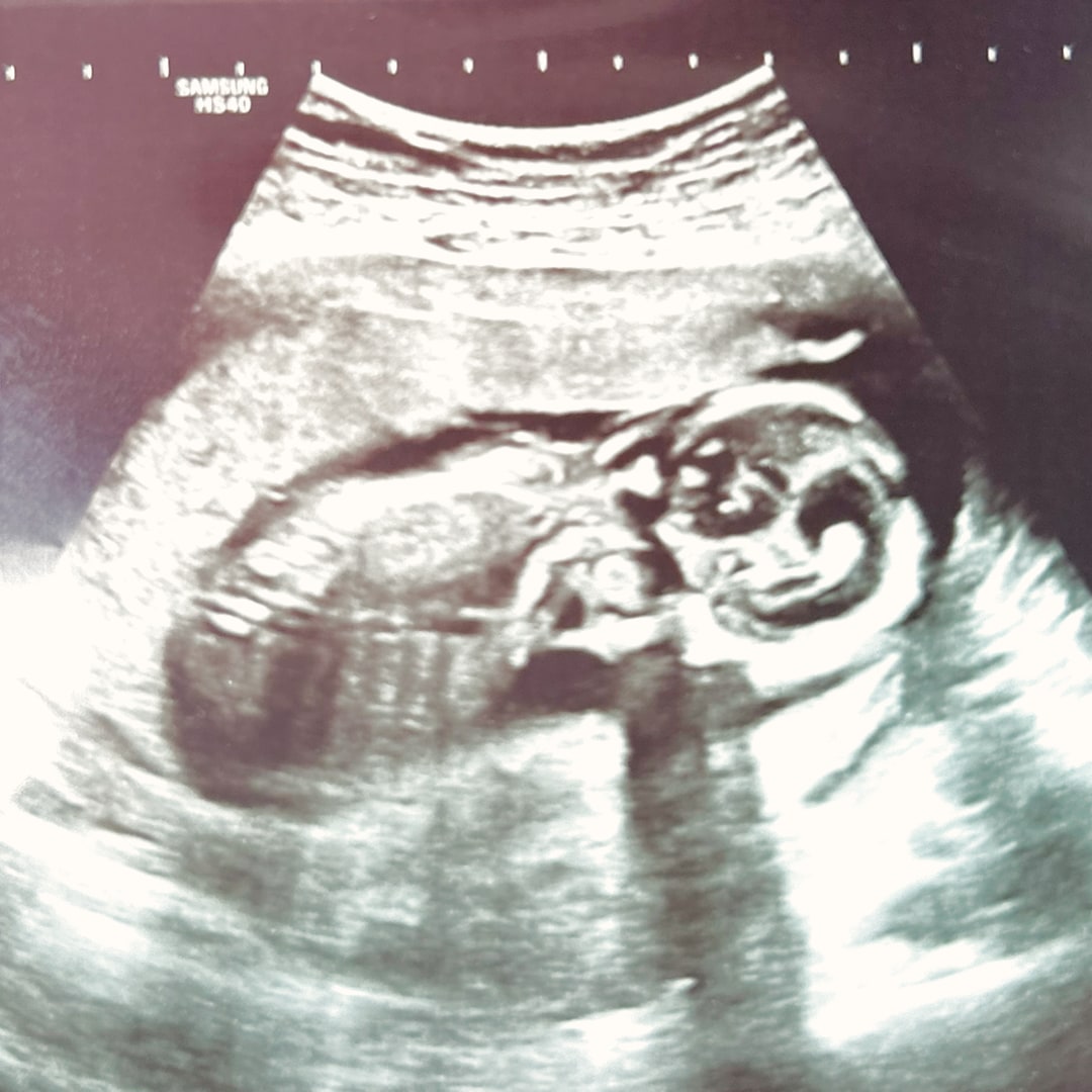 Photo shared by Shannon for their Babylist baby registry.