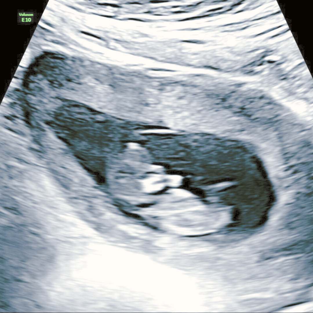 Photo shared by Violeta for their Babylist baby registry.