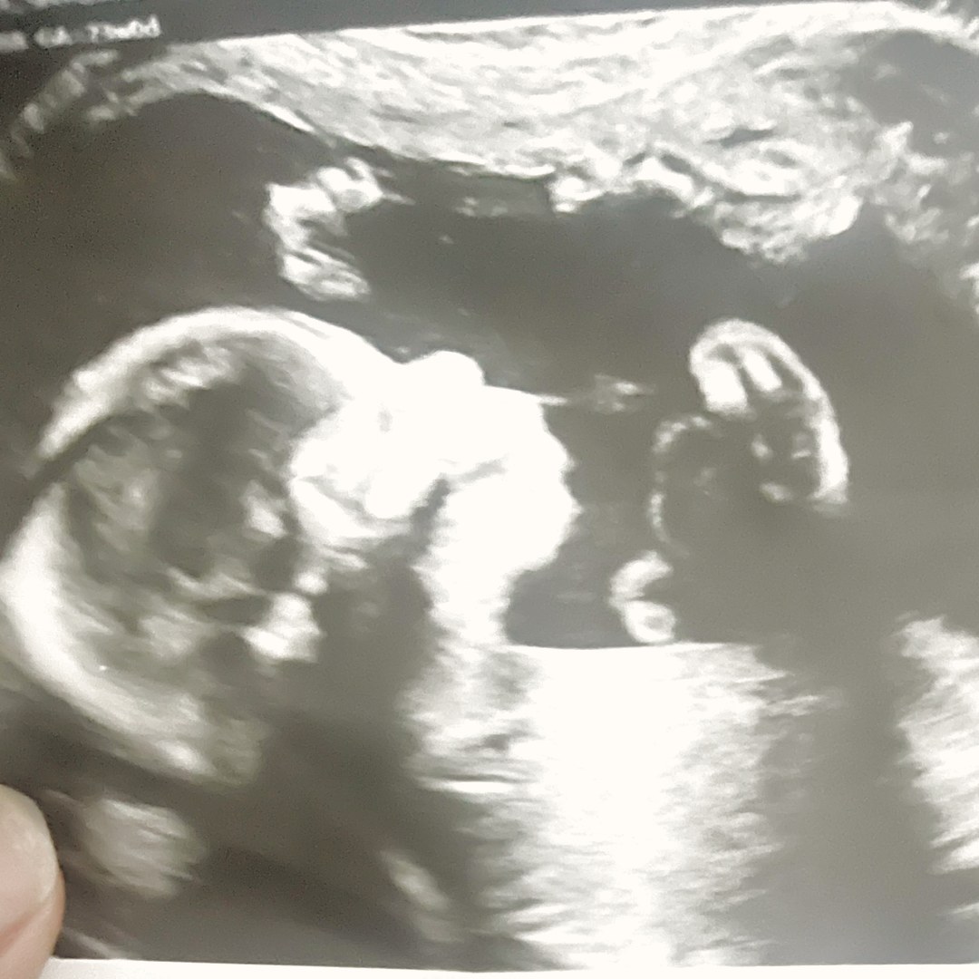 Photo shared by Shyquasia for their Babylist baby registry.