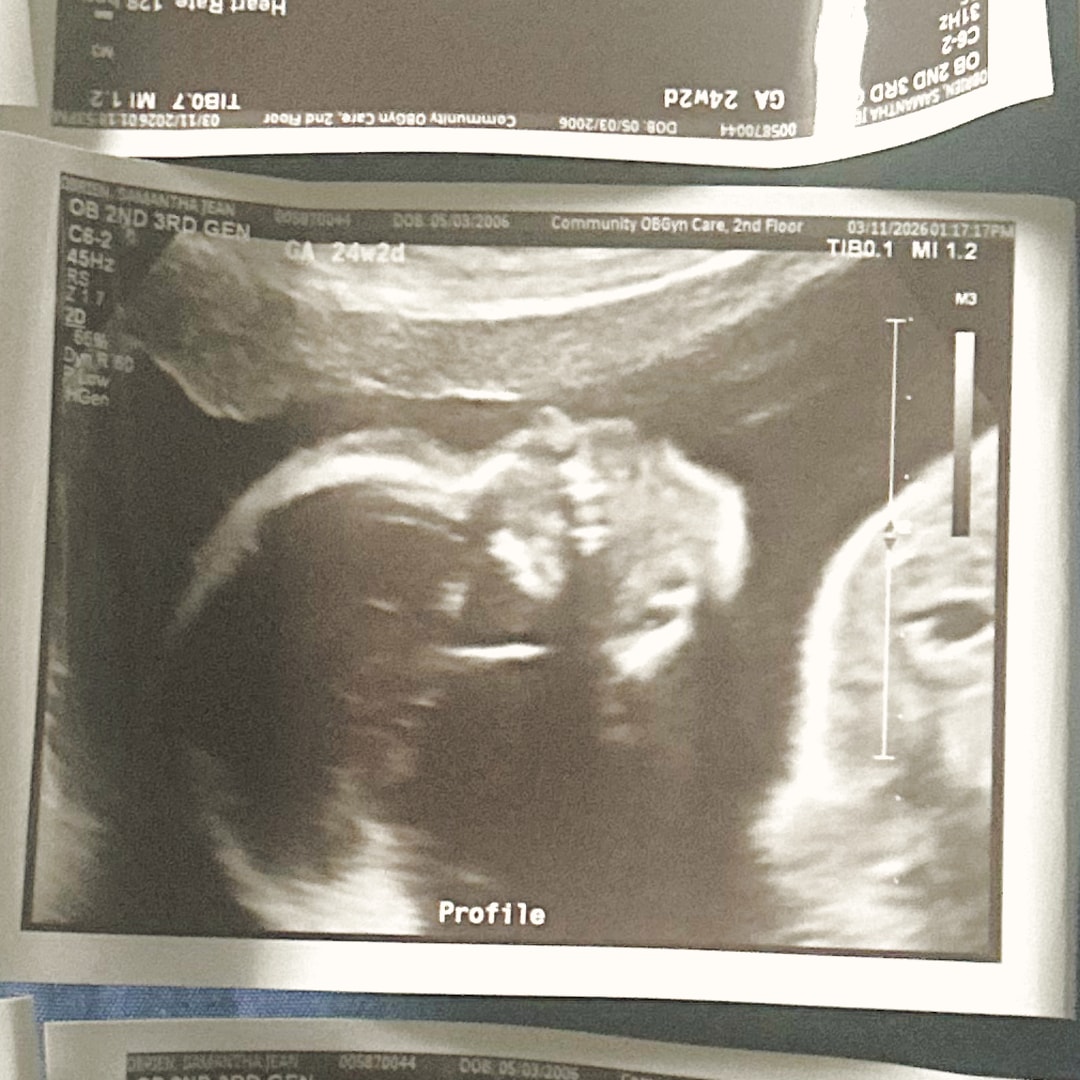 Photo shared by Samantha for their Babylist baby registry.