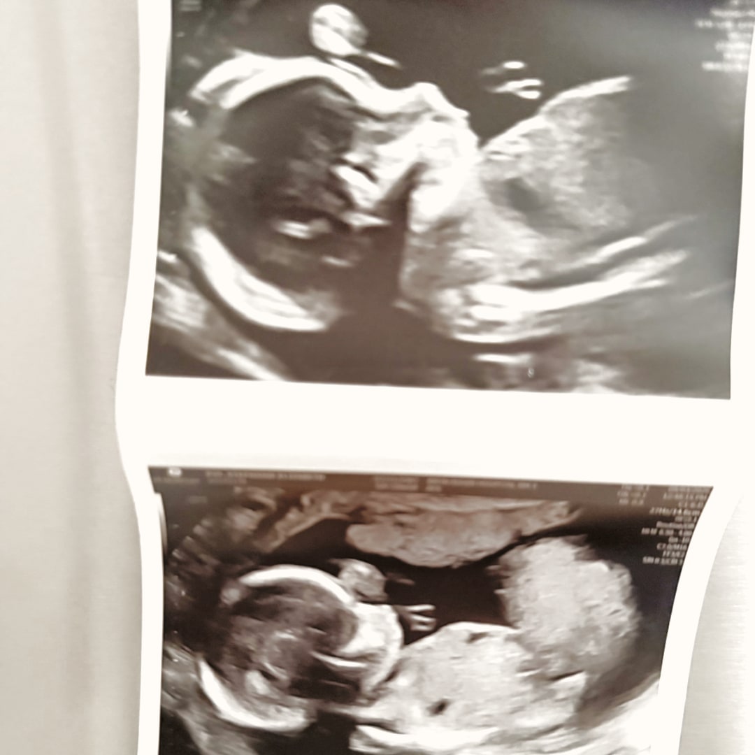 Photo shared by Stephanie for their Babylist baby registry.