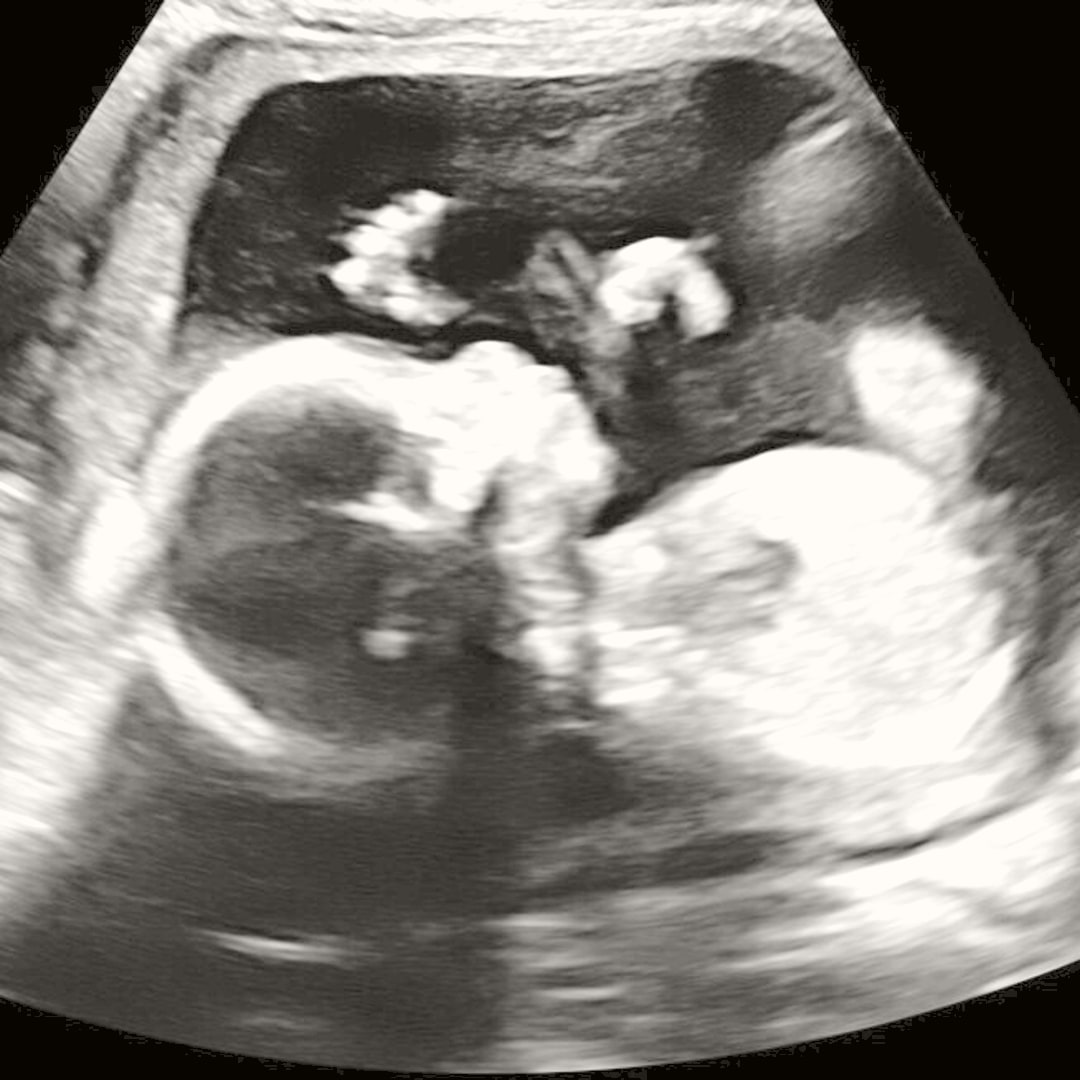 Photo shared by Jessica for their Babylist baby registry.