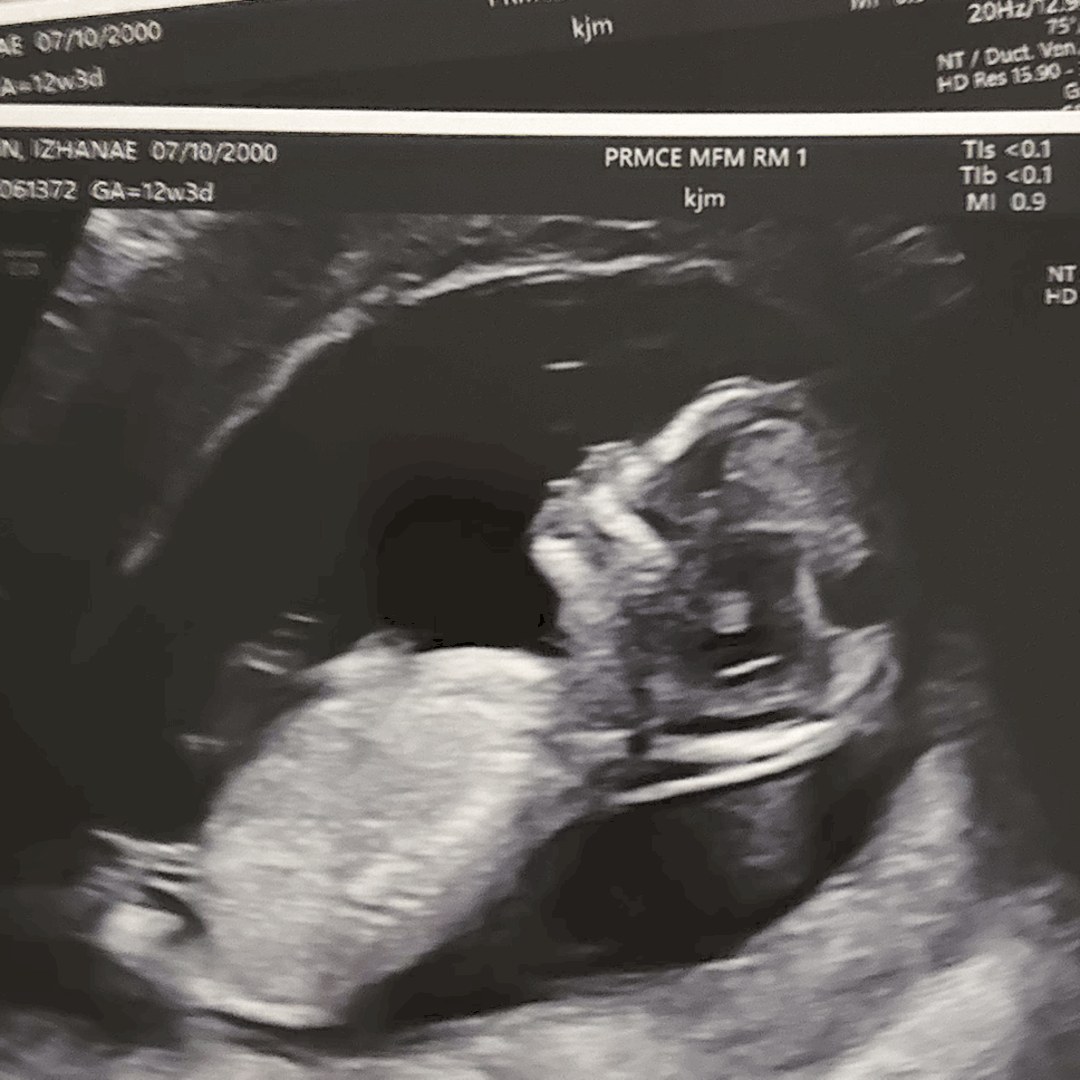 Photo shared by Izhanae for their Babylist baby registry.