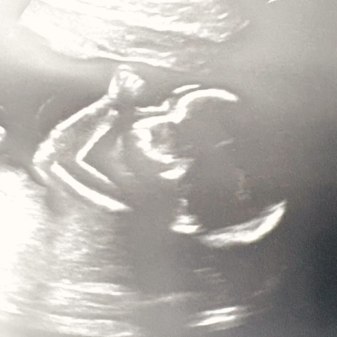 Photo shared by Elizabeth for their Babylist baby registry.