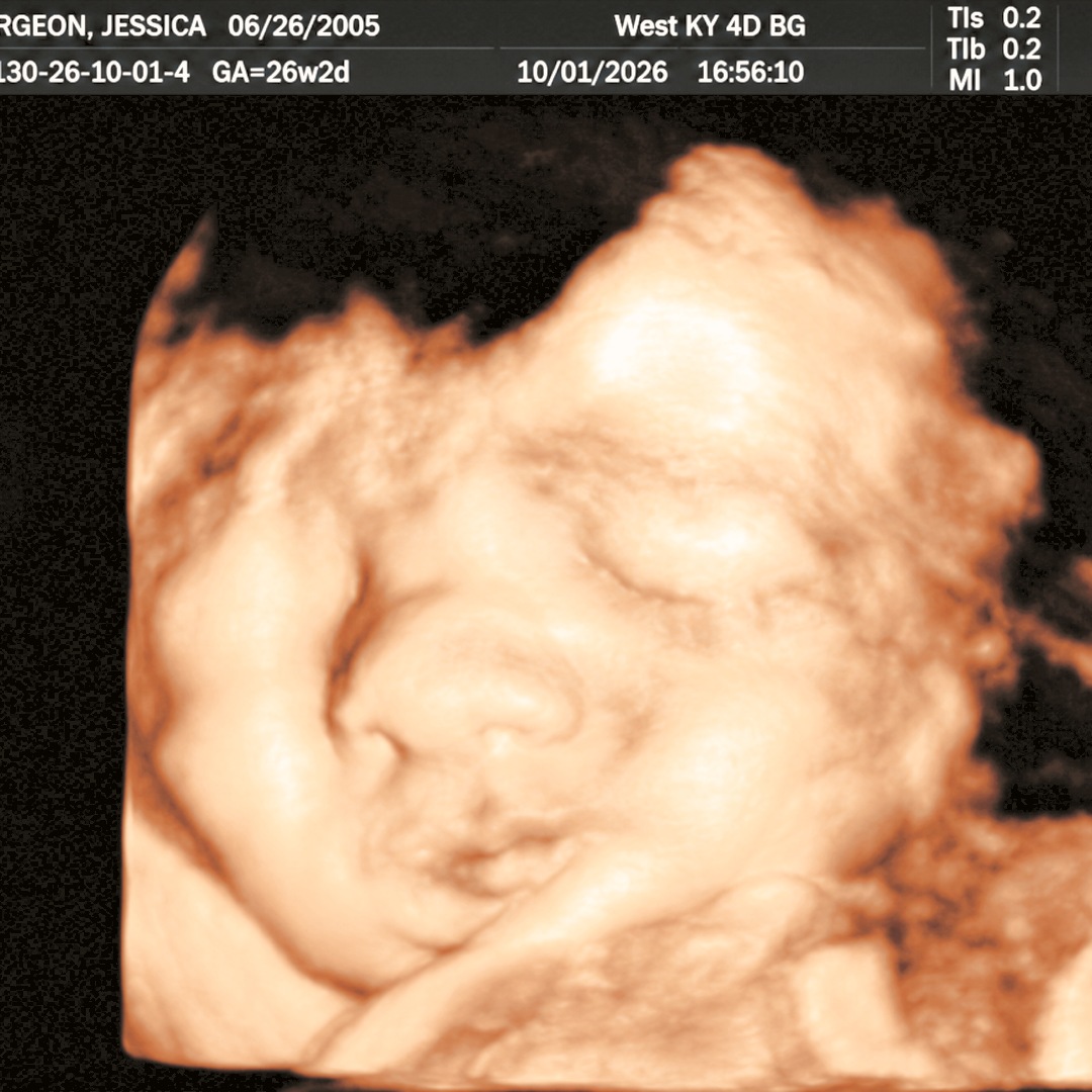 Photo shared by Jessica for their Babylist baby registry.