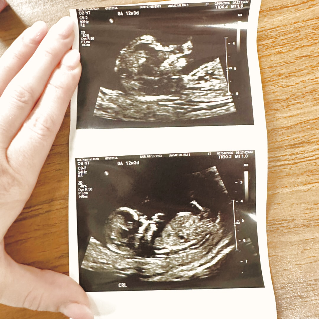 Photo shared by Hannah for their Babylist baby registry.