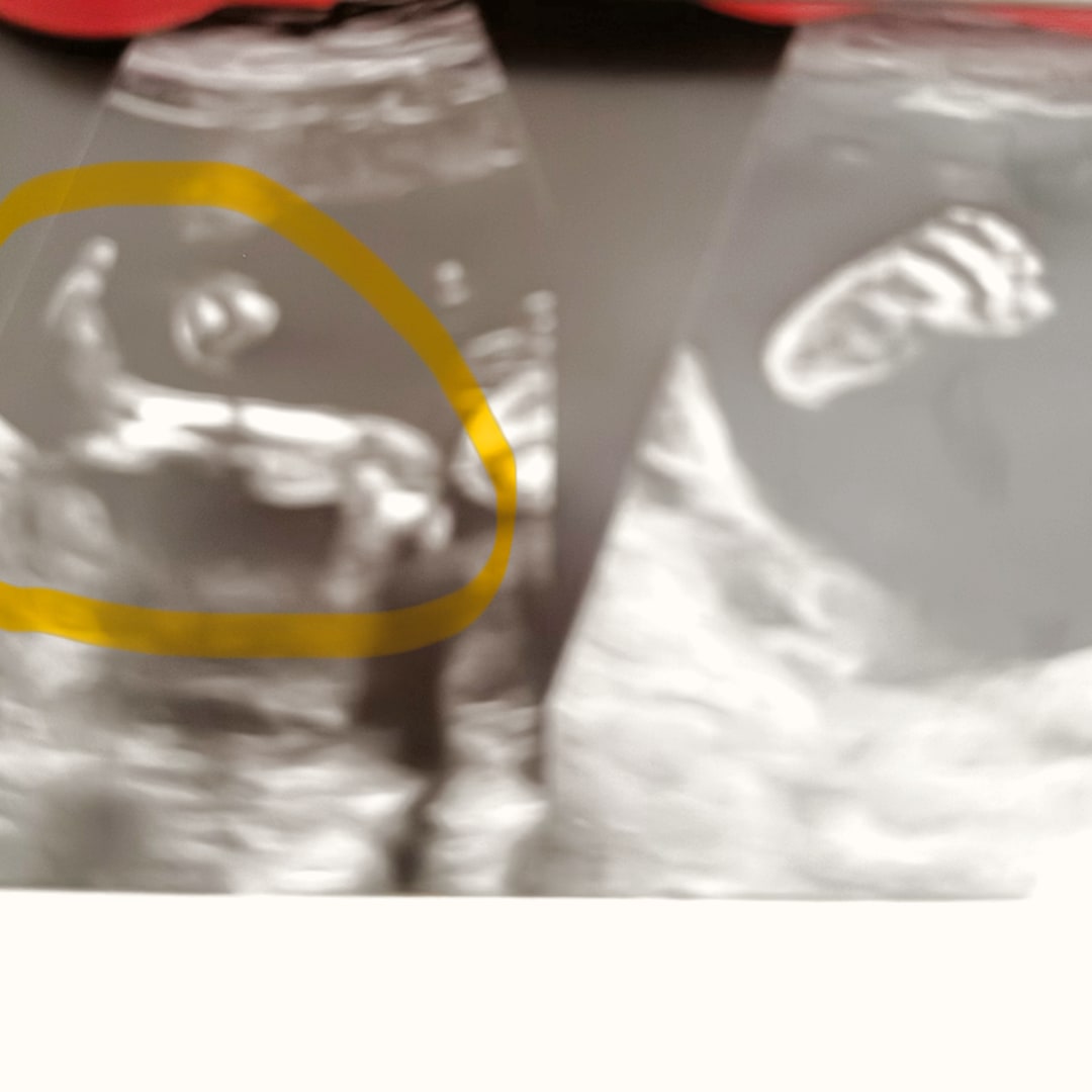 Photo shared by Stephanie for their Babylist baby registry.
